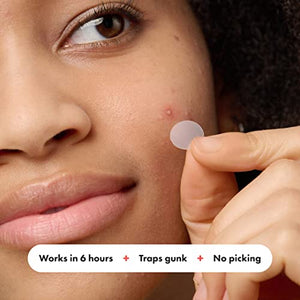 Mighty Patch Original from Hero Cosmetics - Hydrocolloid Acne Pimple Patch for Covering Zits and Blemishes, Spot Stickers for Face and Skin, Vegan-friendly and Not Tested on Animals (72 Count)